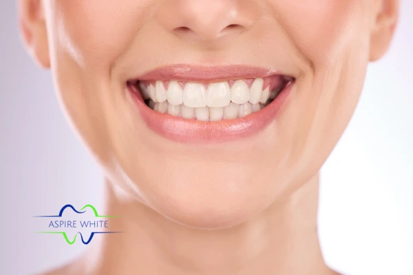 Follow your teeth whitening aftercare Leicester to prolong your whiter smile!